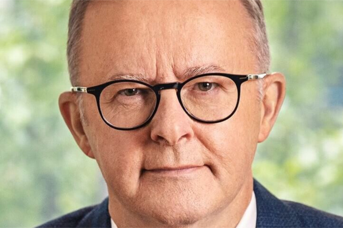 anthony albanese